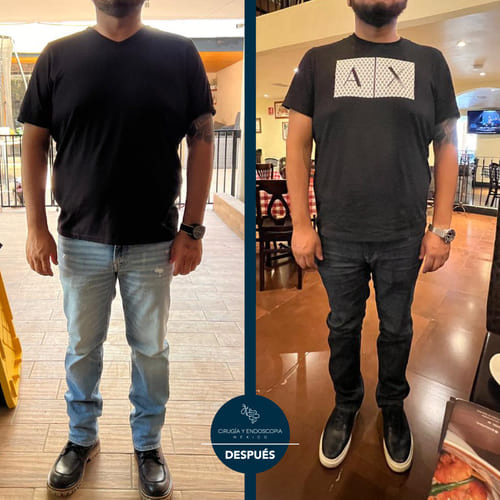 Cirugía y endoscopia en México