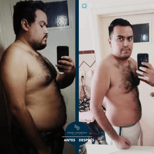 Cirugía y endoscopia en México