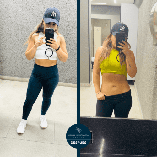 Cirugía y endoscopia en México