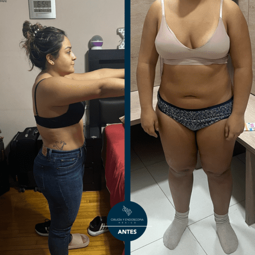 Cirugía y endoscopia en México