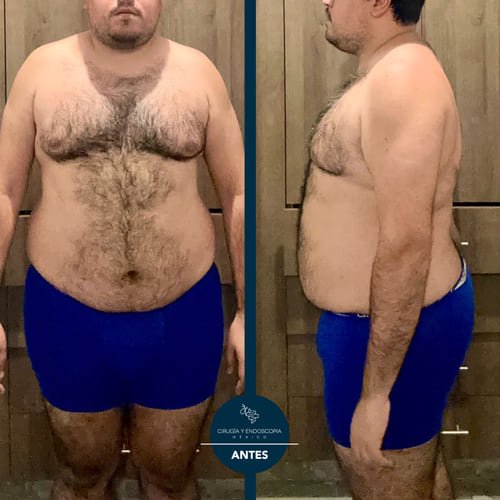 Cirugía y endoscopia en México