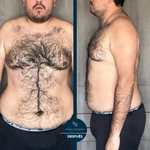 Cirugía y endoscopia en México