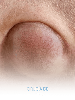 Cirugía y endoscopia en México